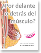 Protesis mamarias por detrás o delante del músculo?