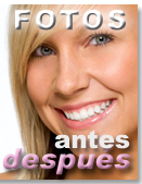 Cirug�a est�tica fotos Antes - Despu�s