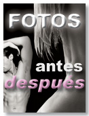 Antes - Después