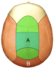 Hair Transplant, scalp areas