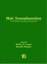 Hair Transplant