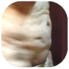 Before Liposuction