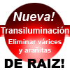 Transiluminación